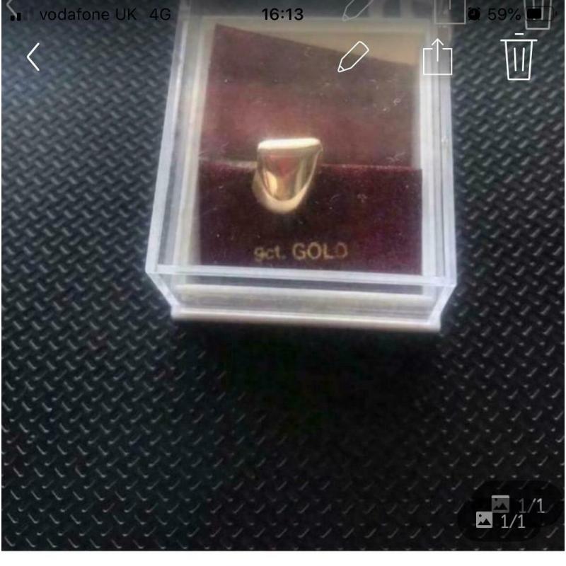 9carat gold tooth - real gold