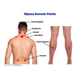golders green 1 day hijama cupping massage diploma course certificate beauty clinic mobile training