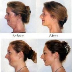 Therapeutic face massage